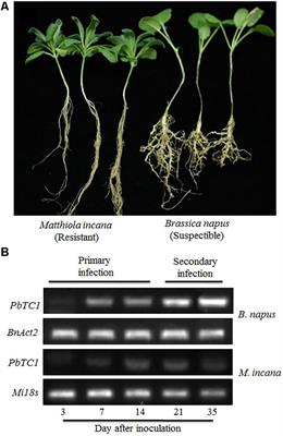 Jasmonic Acid-Mediated Aliphatic Glucosinolate Metabolism Is Involved in Clubroot Disease Development in Brassica napus L.